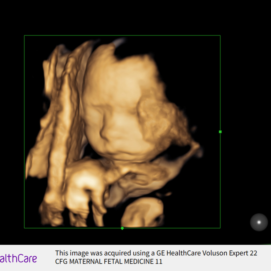 Photo shared by Peyton for their Babylist baby registry.