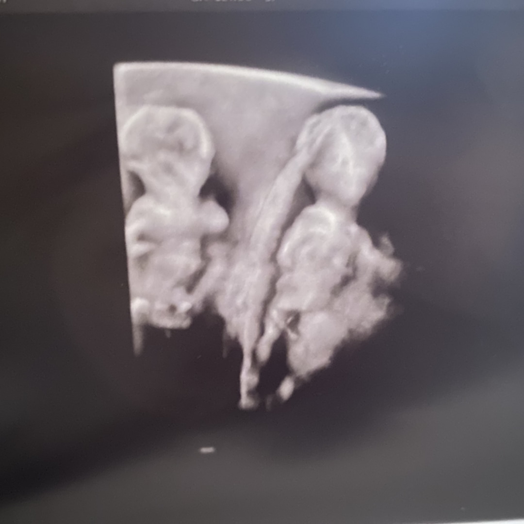 Photo shared by Maura for their Babylist baby registry.