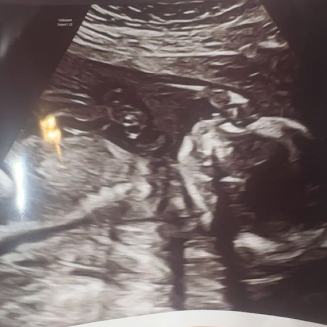 Photo shared by Emma for their Babylist baby registry.