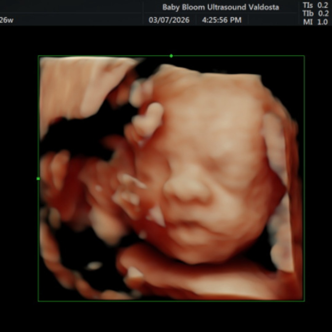 Photo shared by Jaime for their Babylist baby registry.