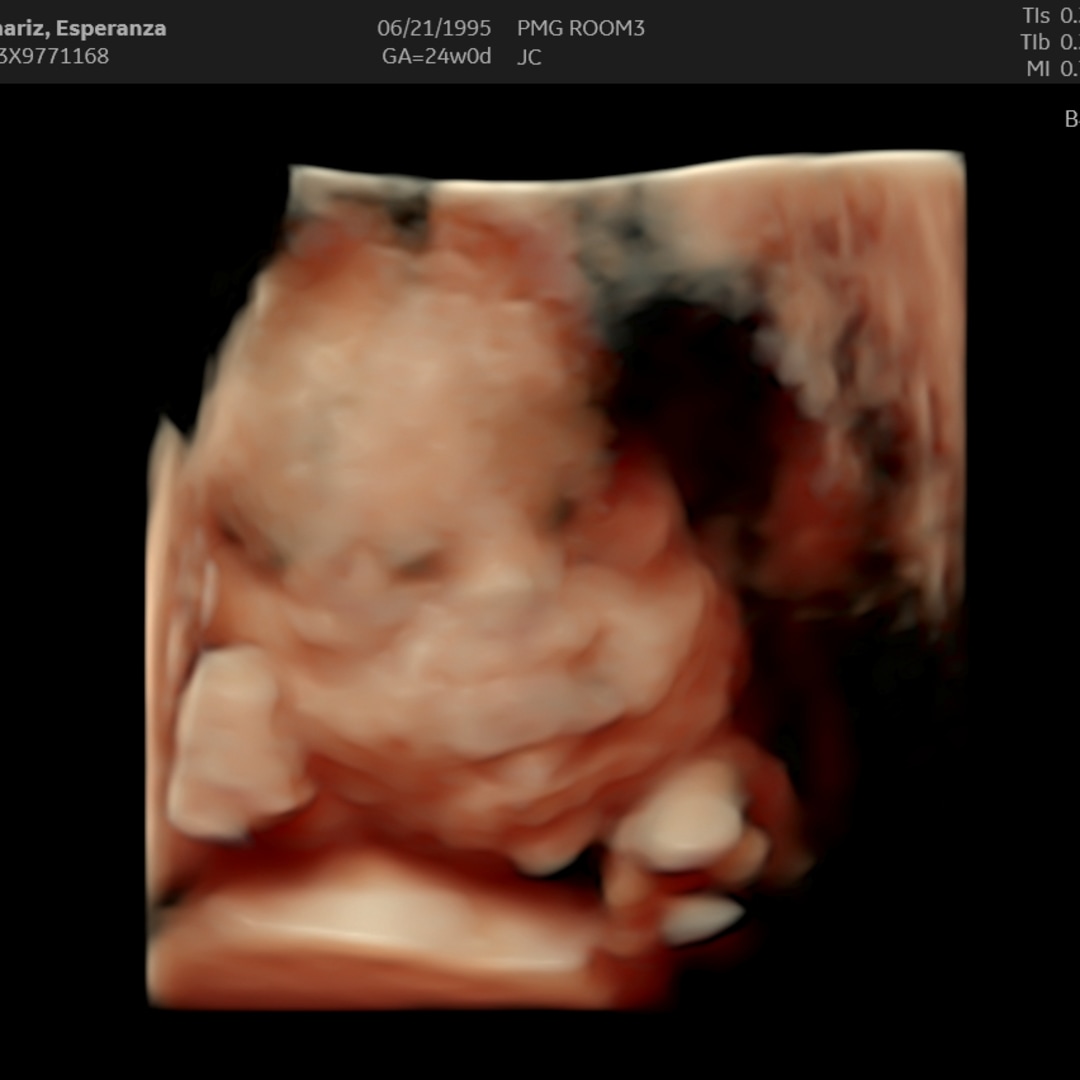 Photo shared by Esperanza for their Babylist baby registry.