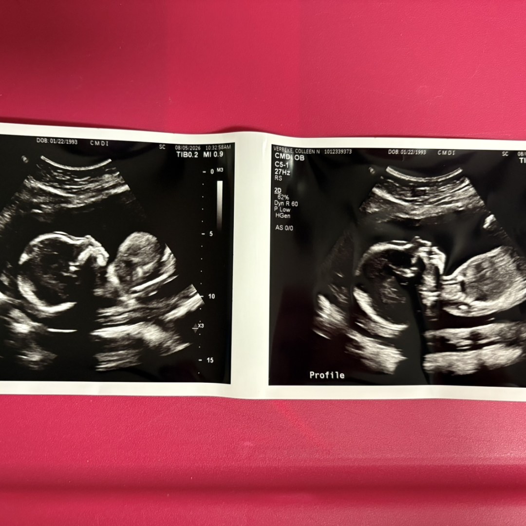 Photo shared by Colleen for their Babylist baby registry.