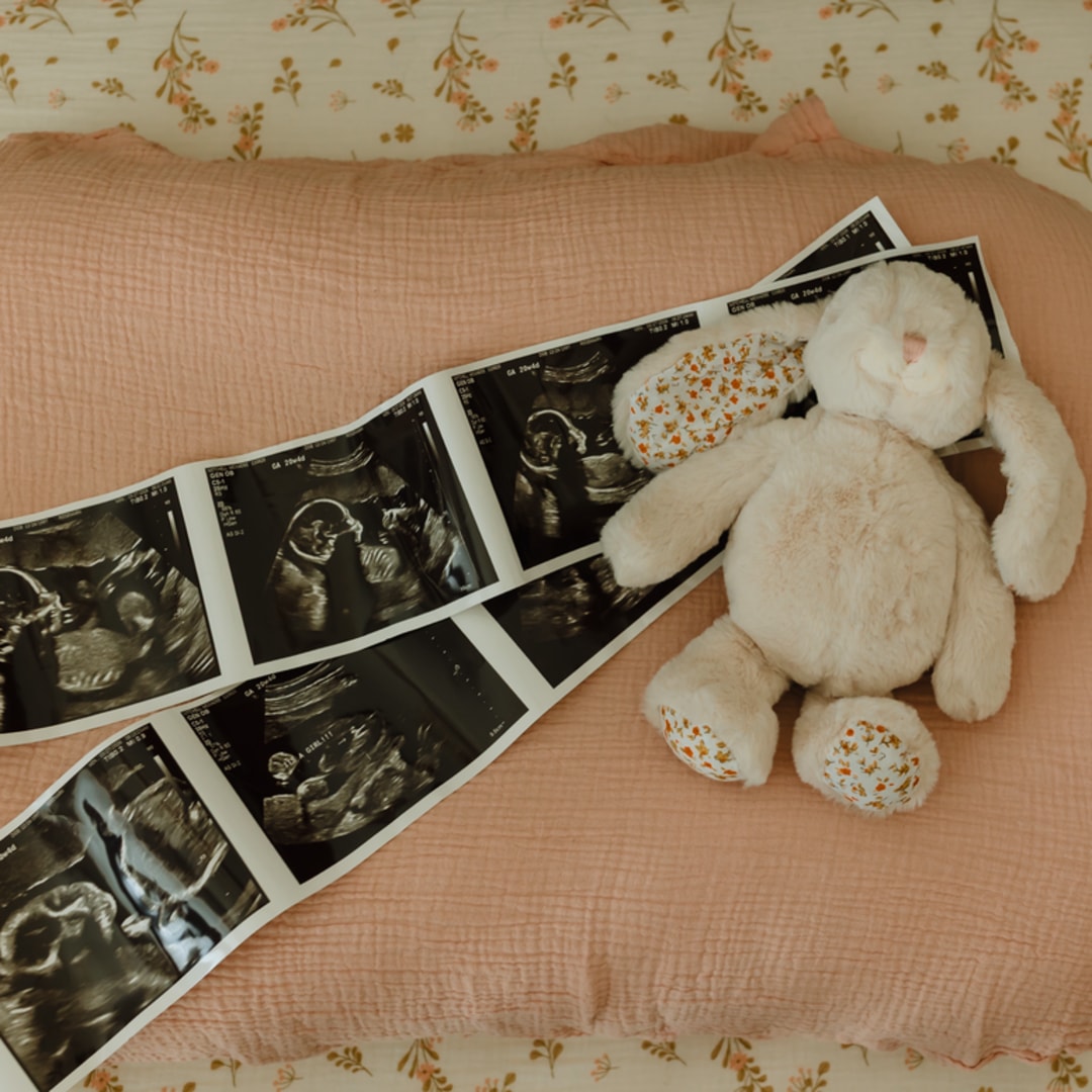 Photo shared by McKadee for their Babylist baby registry.