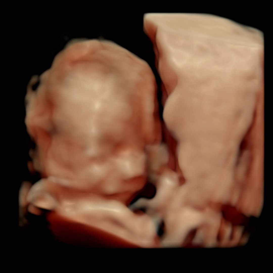 Photo shared by Christina for their Babylist baby registry.