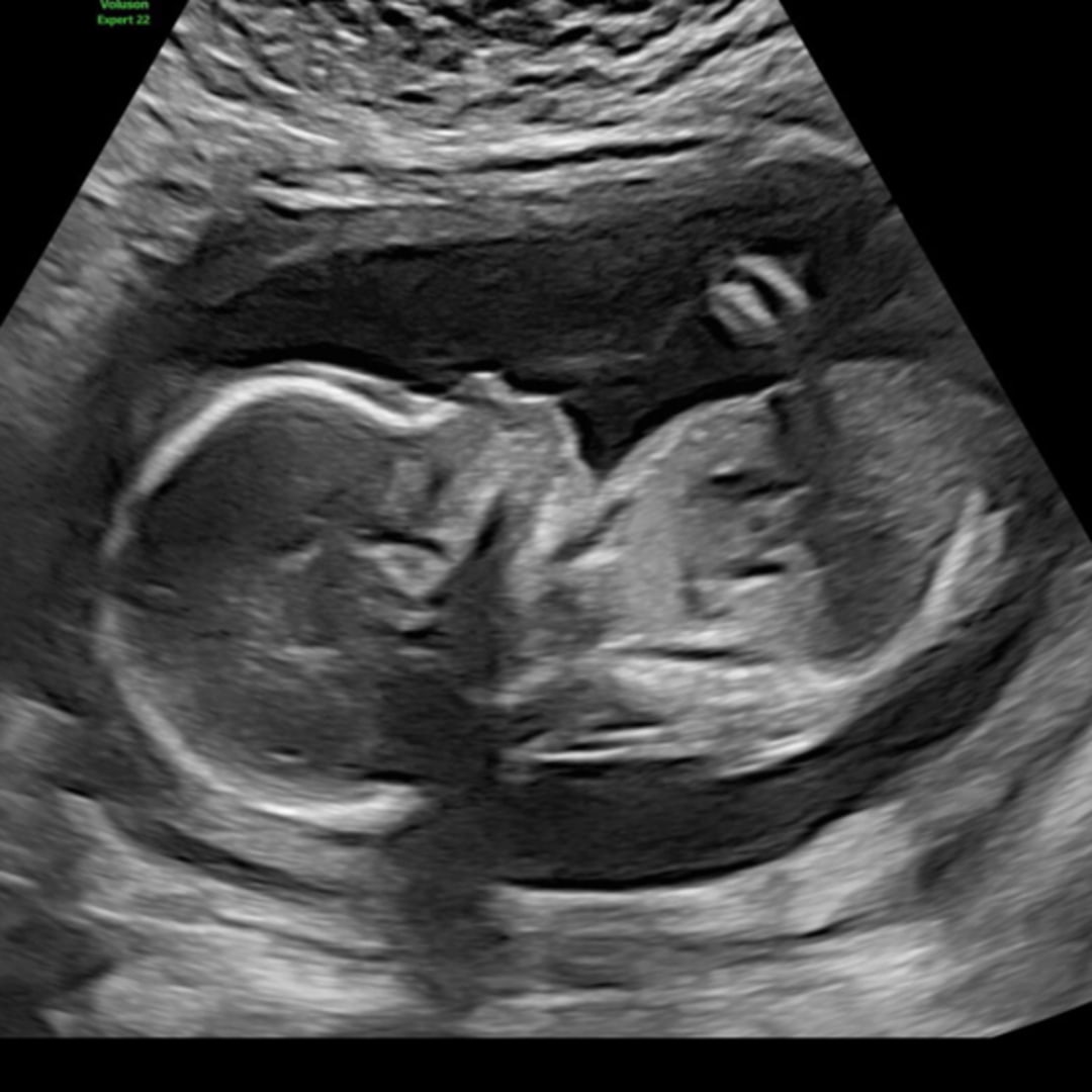 Photo shared by Yensi for their Babylist baby registry.