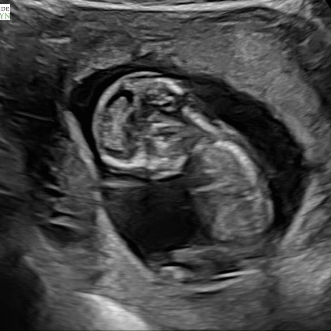 Photo shared by Lindsey for their Babylist baby registry.