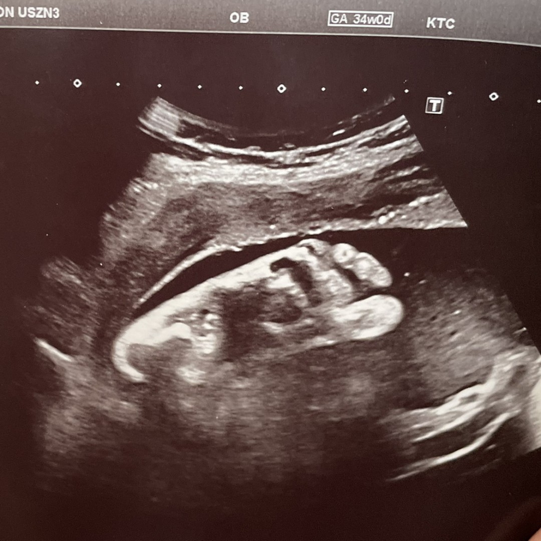 Photo shared by Calli for their Babylist baby registry.