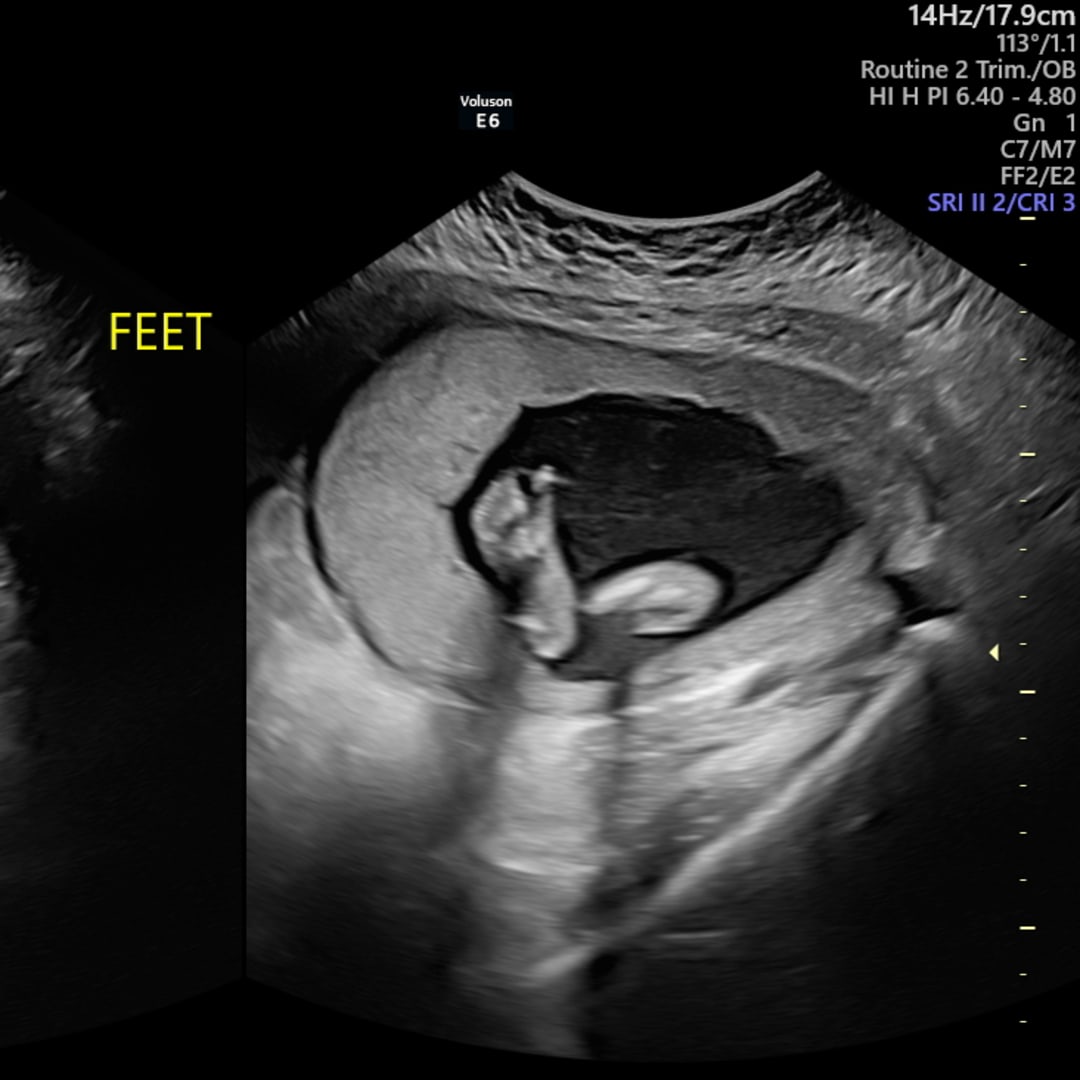 Photo shared by Chloe for their Babylist baby registry.