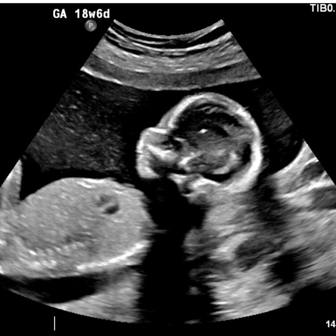 Photo shared by Shadalyn for their Babylist baby registry.