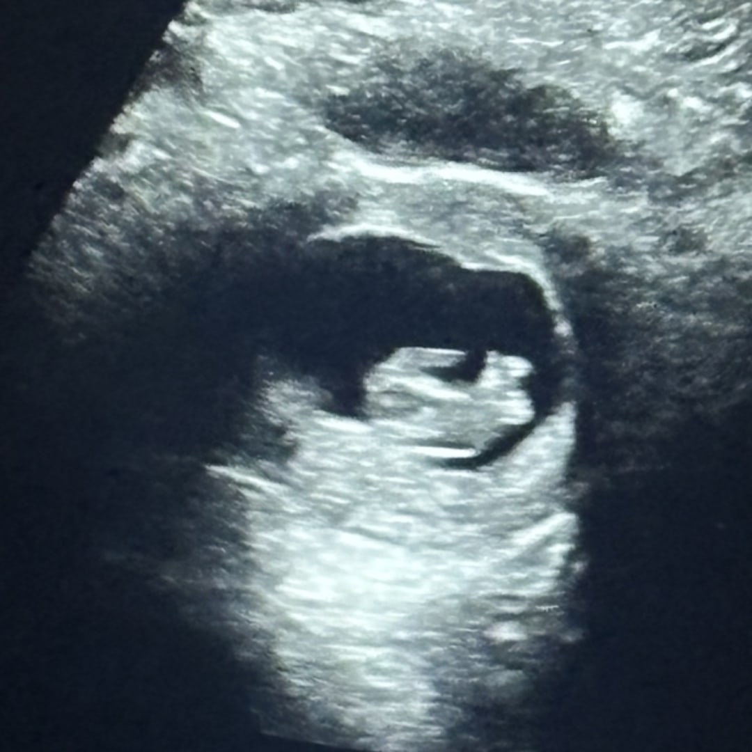 Photo shared by Allanah for their Babylist baby registry.