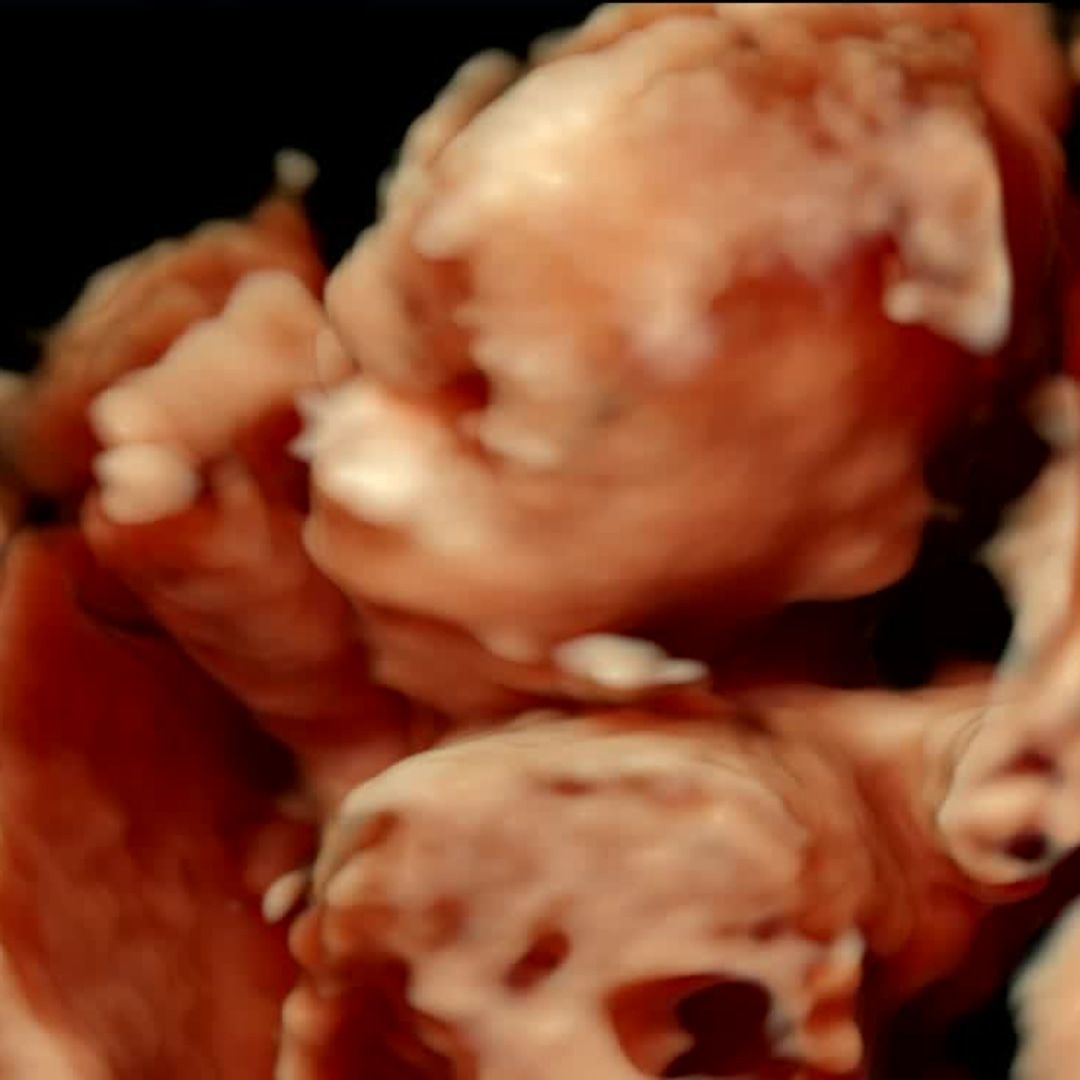 Photo shared by Kristin for their Babylist baby registry.