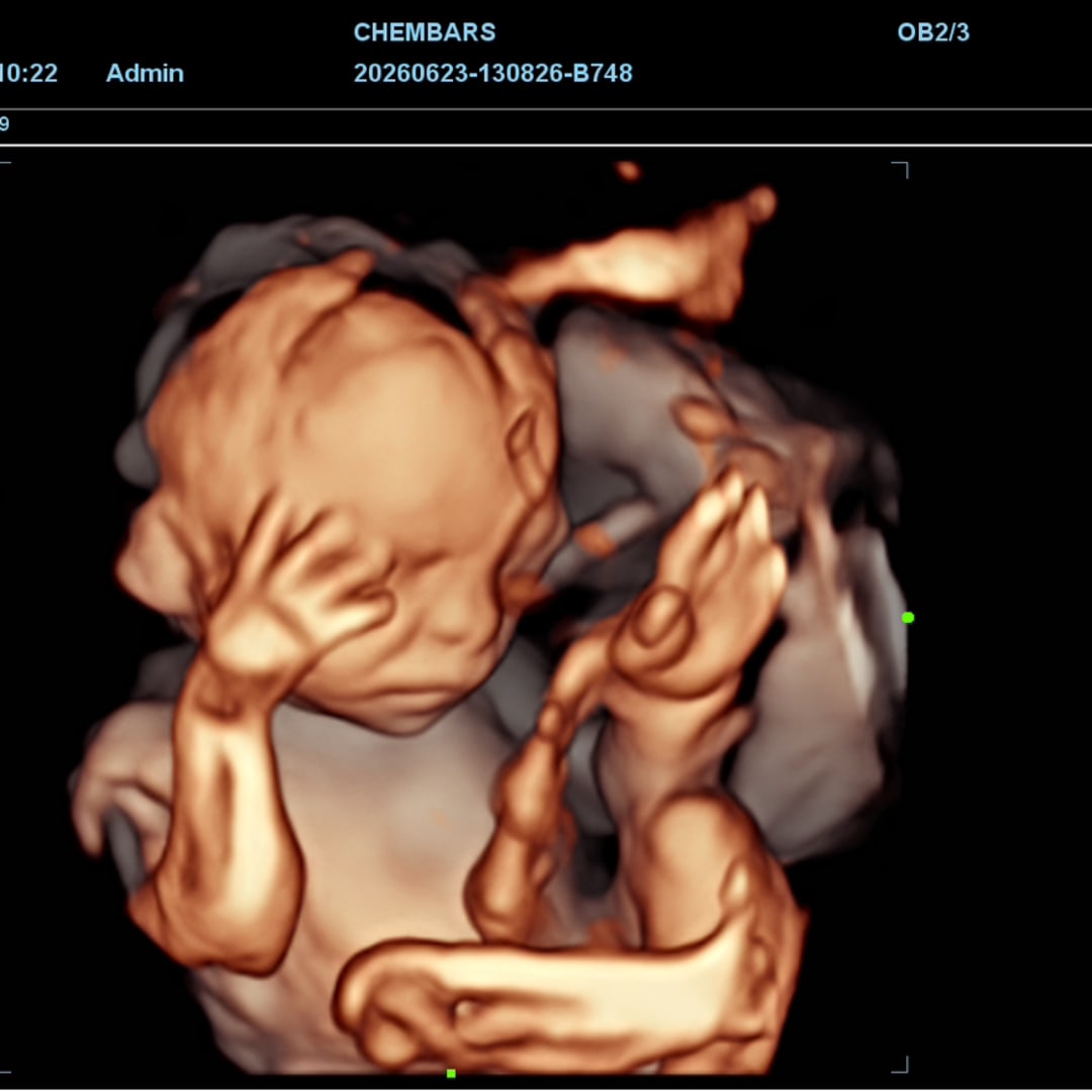 Photo shared by Christiana for their Babylist baby registry.
