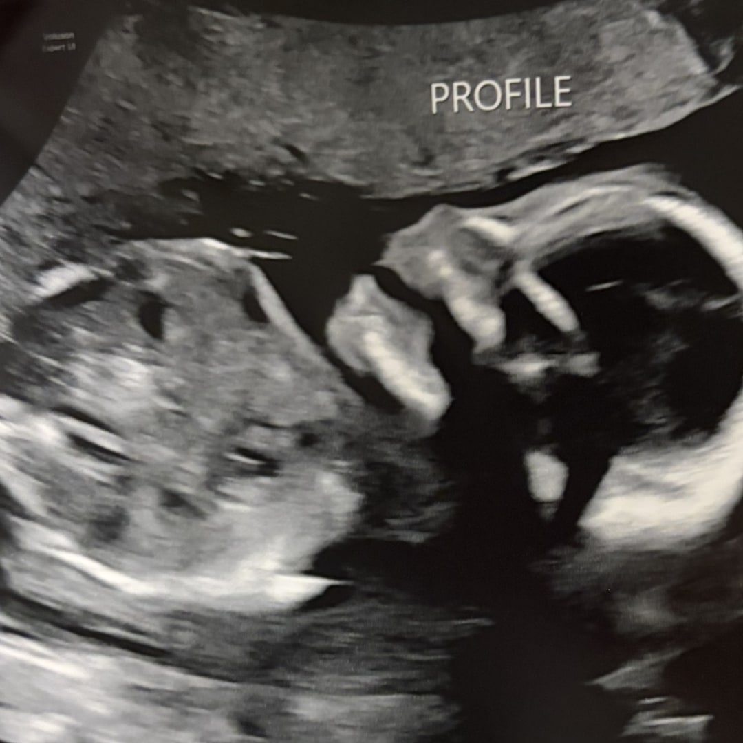 Photo shared by Justin for their Babylist baby registry.