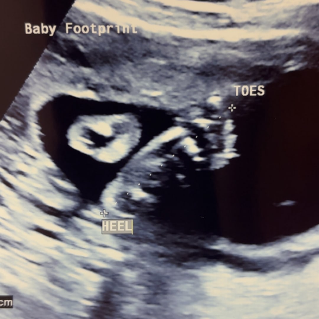 Photo shared by Ashton for their Babylist baby registry.