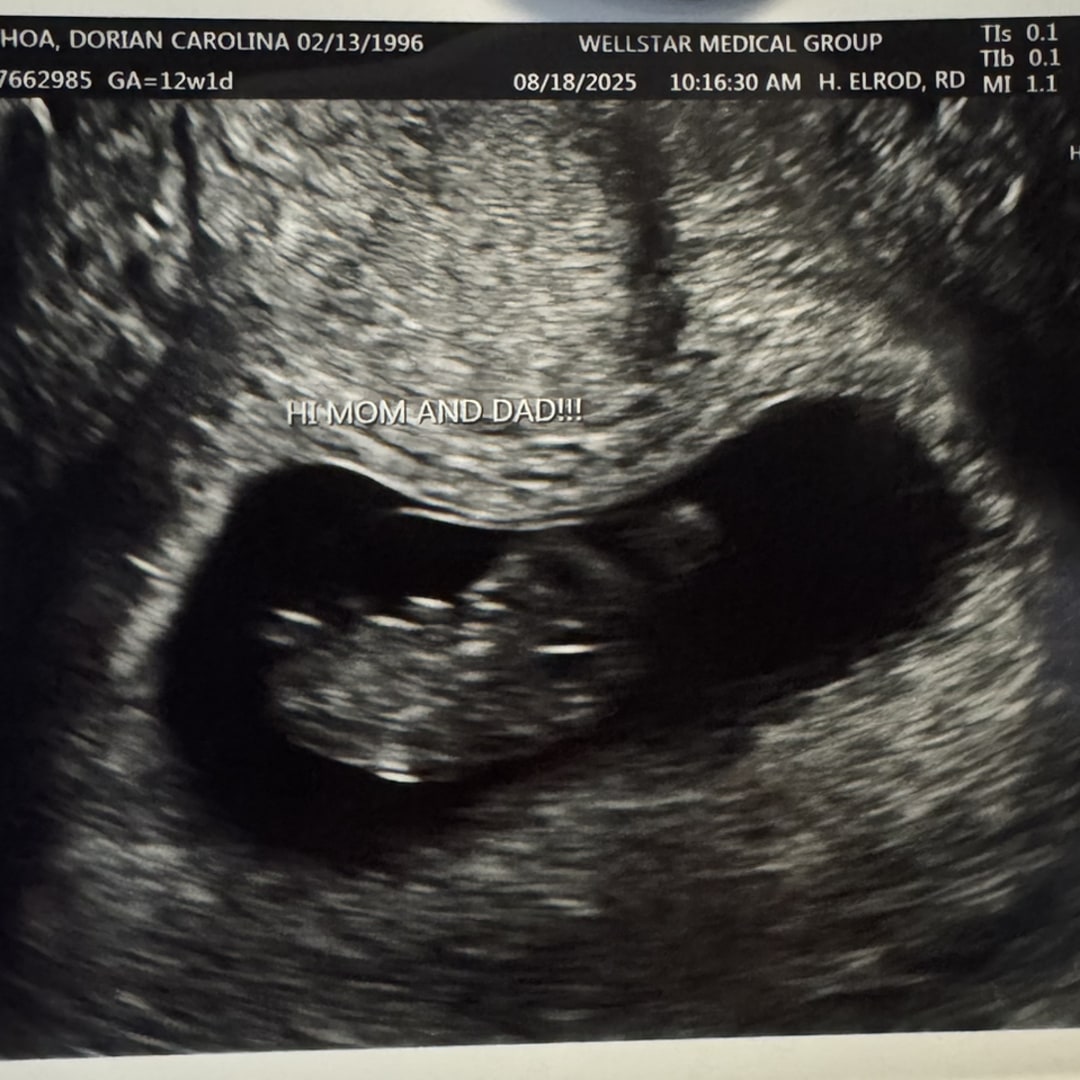 Photo shared by Carolina for their Babylist baby registry.