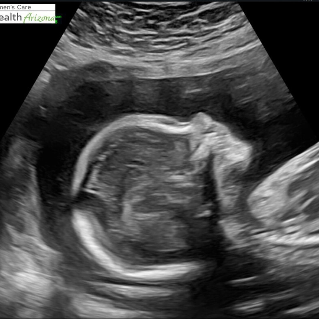 Photo shared by Meredith and Will for their Babylist baby registry.
