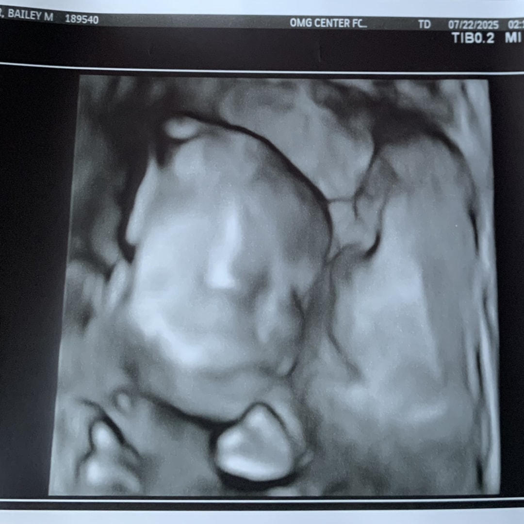Photo shared by Bailey for their Babylist baby registry.
