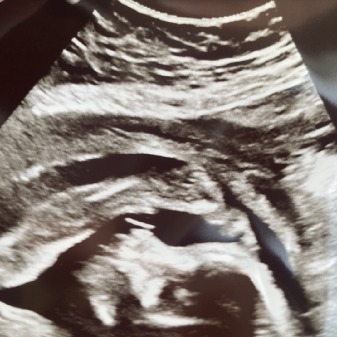 Photo shared by Molly for their Babylist baby registry.