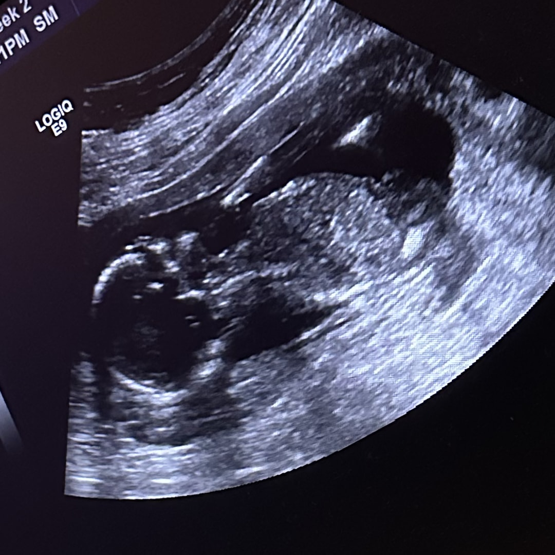 Photo shared by Billy for their Babylist baby registry.