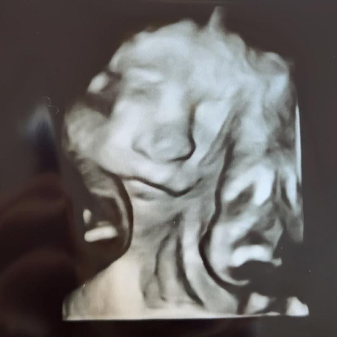 Photo shared by Kennadi for their Babylist baby registry.