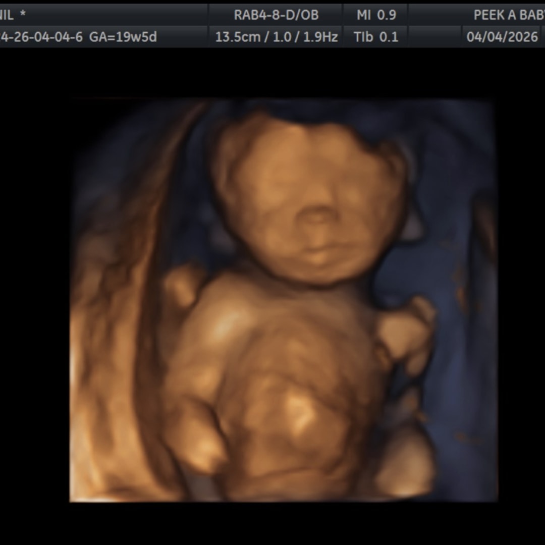 Photo shared by Janil for their Babylist baby registry.