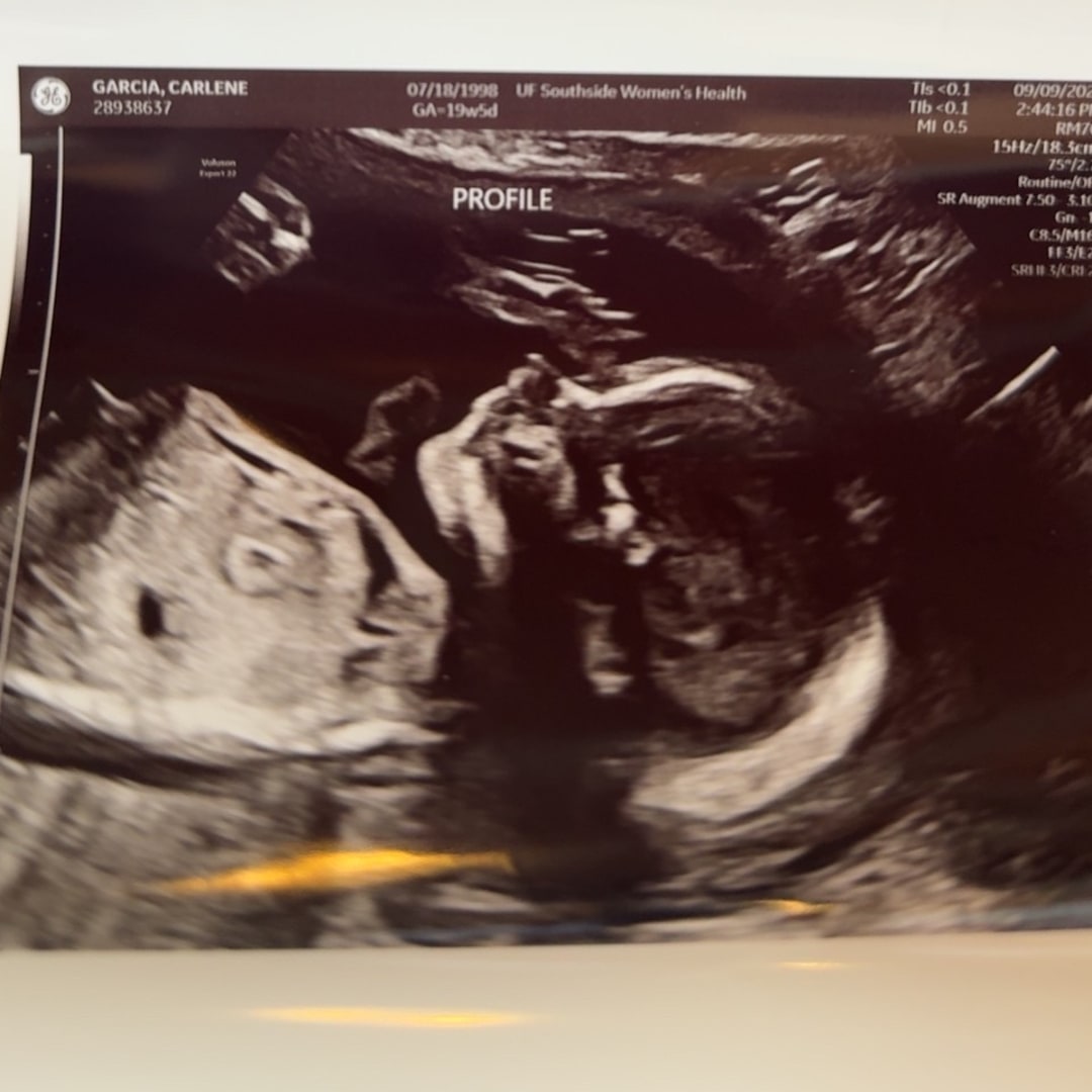 Photo shared by Carlene for their Babylist baby registry.