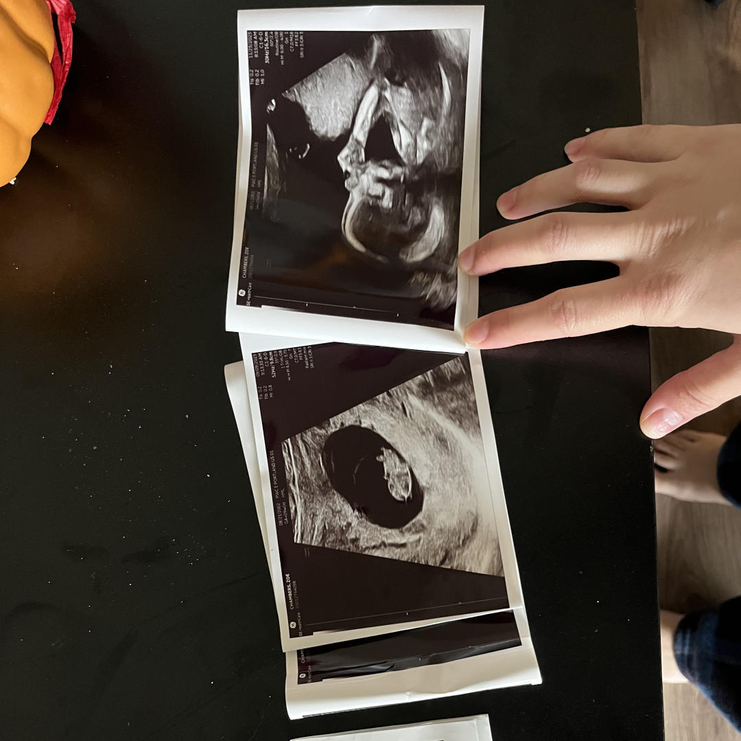 Photo shared by Zoe for their Babylist baby registry.