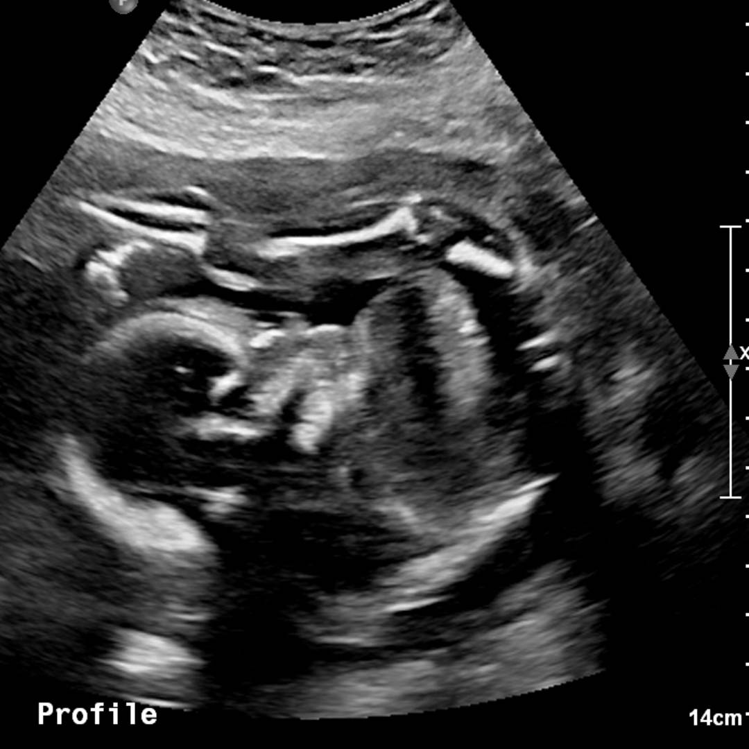 Photo shared by Trenda for their Babylist baby registry.