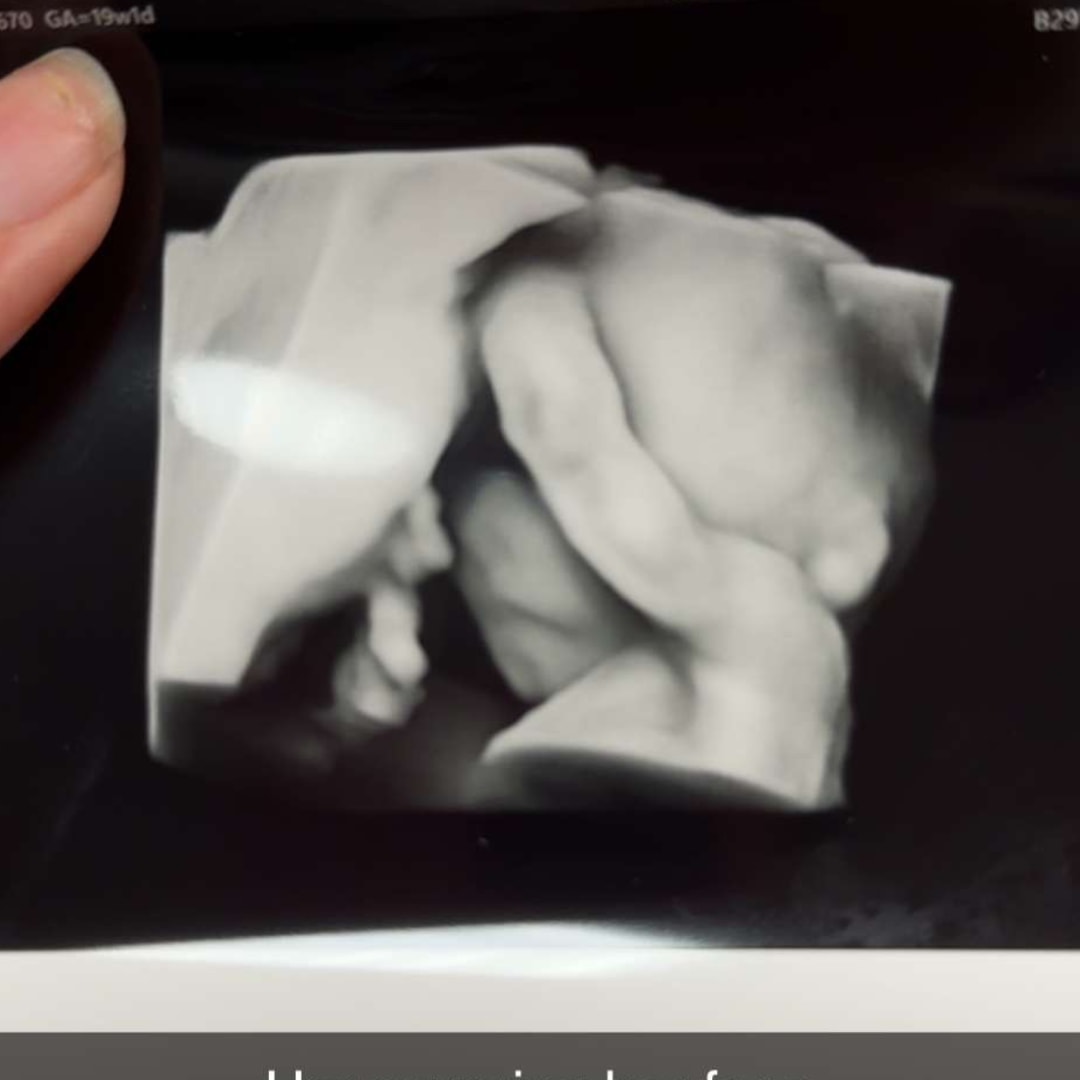 Photo shared by Baylee for their Babylist baby registry.