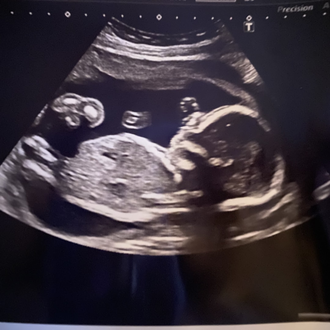 Photo shared by Vanessa for their Babylist baby registry.