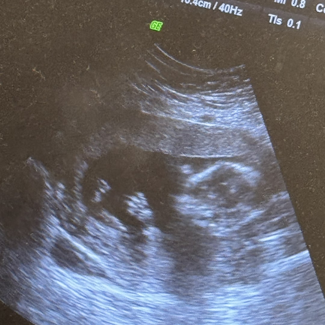 Photo shared by Allie for their Babylist baby registry.