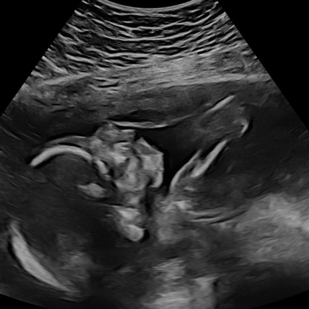 Photo shared by Julia for their Babylist baby registry.