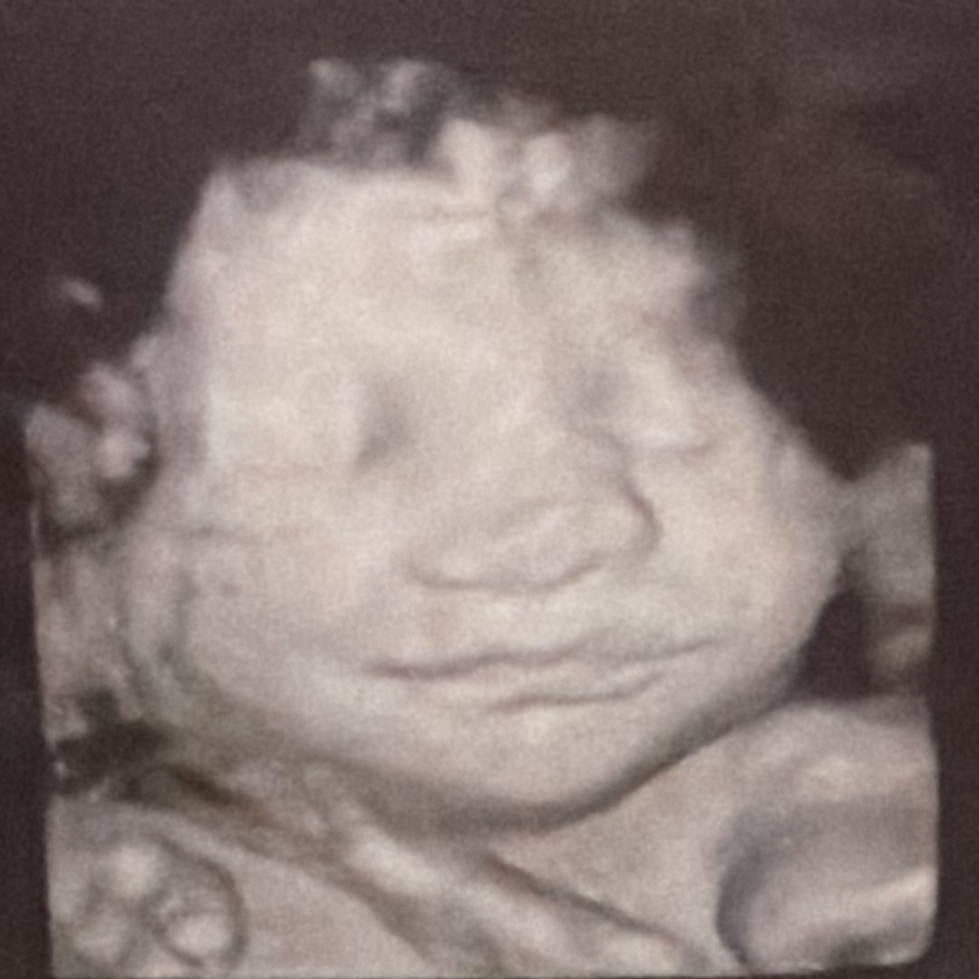 Photo shared by Skyler for their Babylist baby registry.