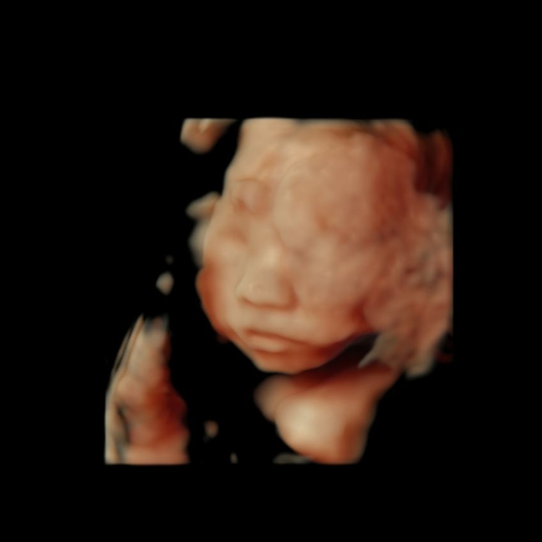 Photo shared by Casey for their Babylist baby registry.