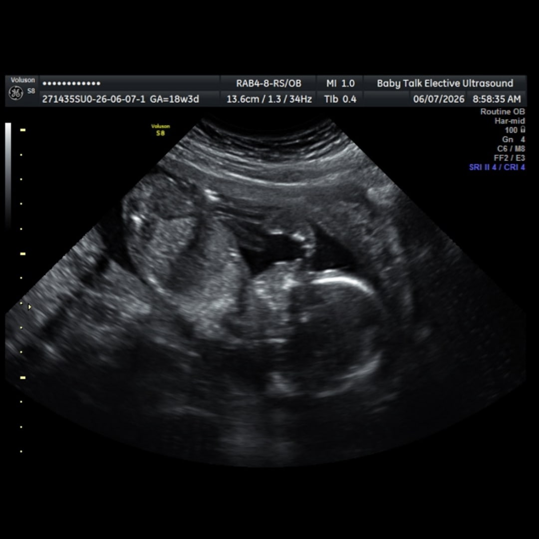 Photo shared by Hayley for their Babylist baby registry.