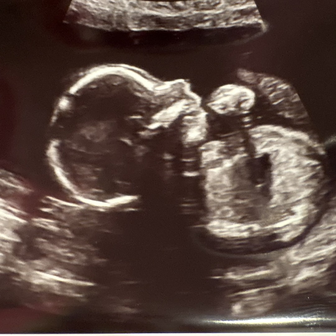 Photo shared by Jennifer for their Babylist baby registry.