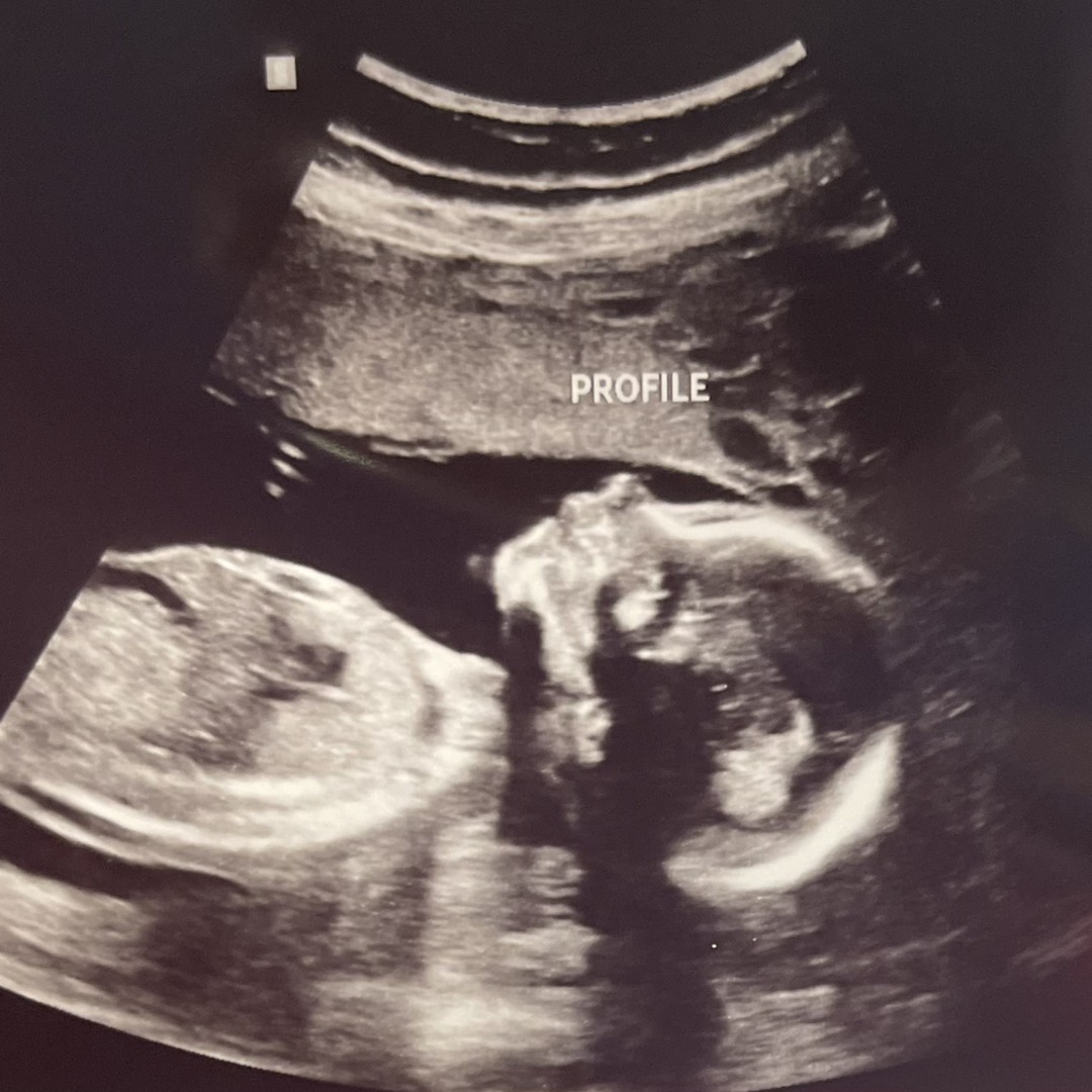 Photo shared by Shannon for their Babylist baby registry.