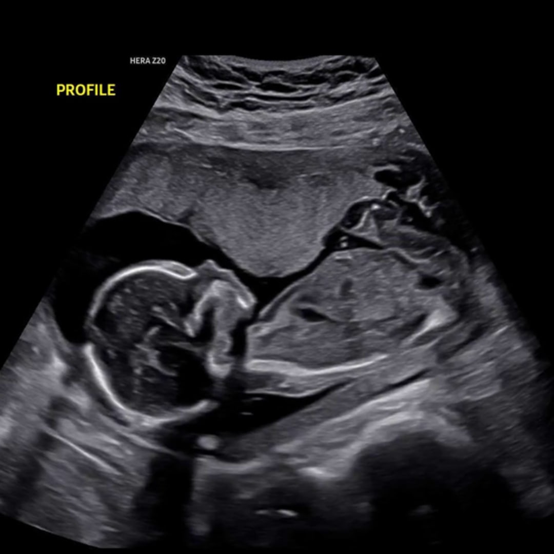 Photo shared by Meredith for their Babylist baby registry.