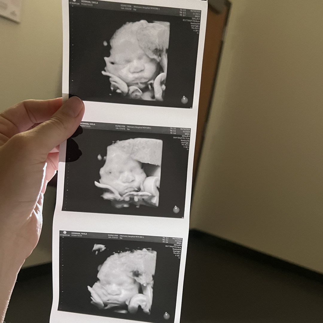 Photo shared by Tayla for their Babylist baby registry.