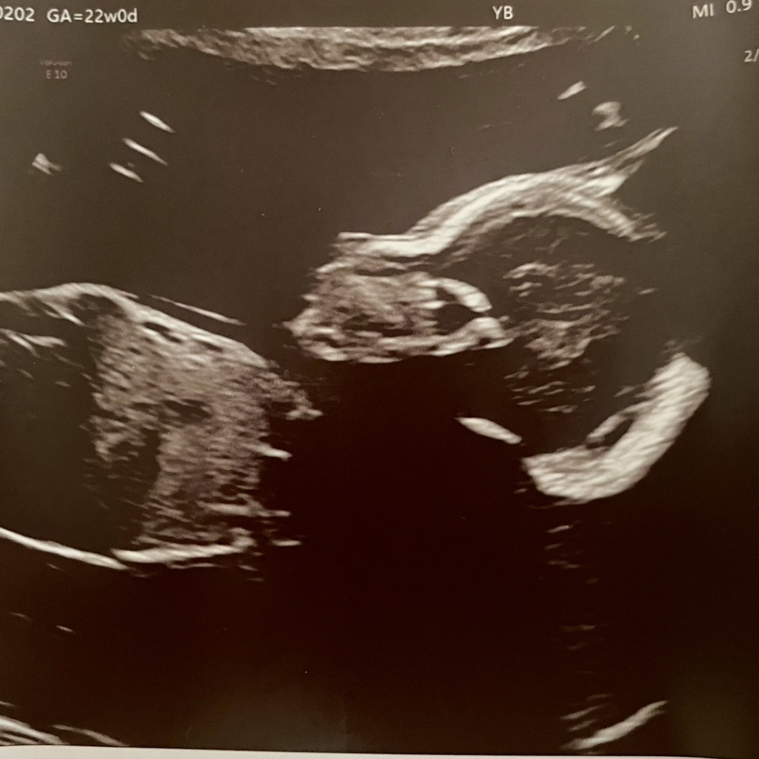 Photo shared by Erin for their Babylist baby registry.