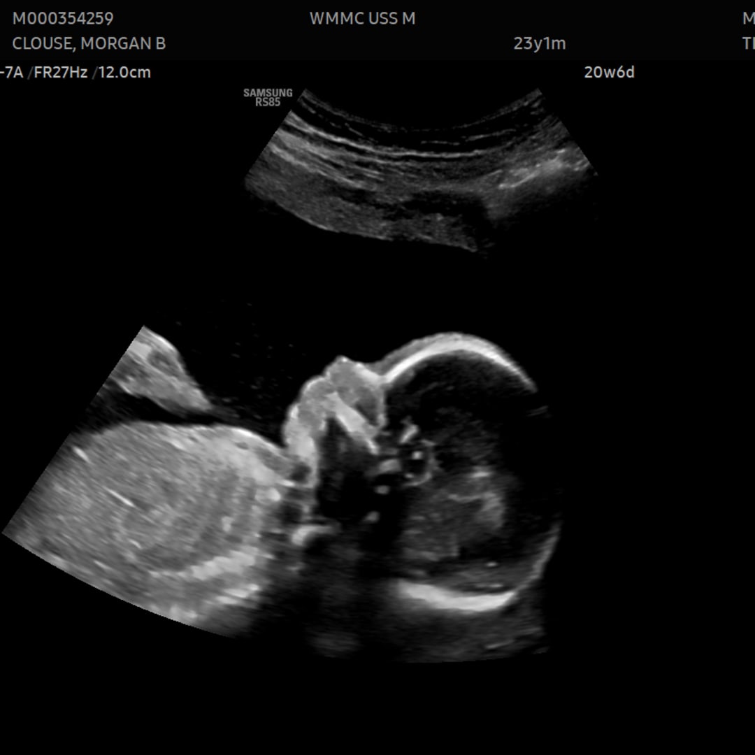 Photo shared by Morgan for their Babylist baby registry.