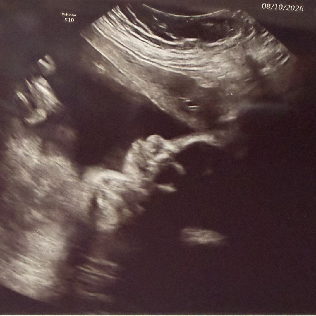 Photo shared by Aalicyah for their Babylist baby registry.