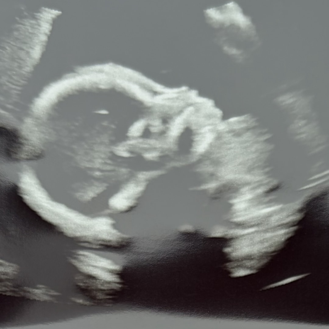 Photo shared by Marcella for their Babylist baby registry.