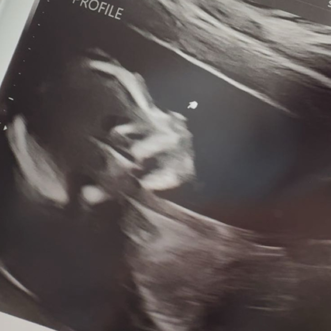 Photo shared by Maggie for their Babylist baby registry.