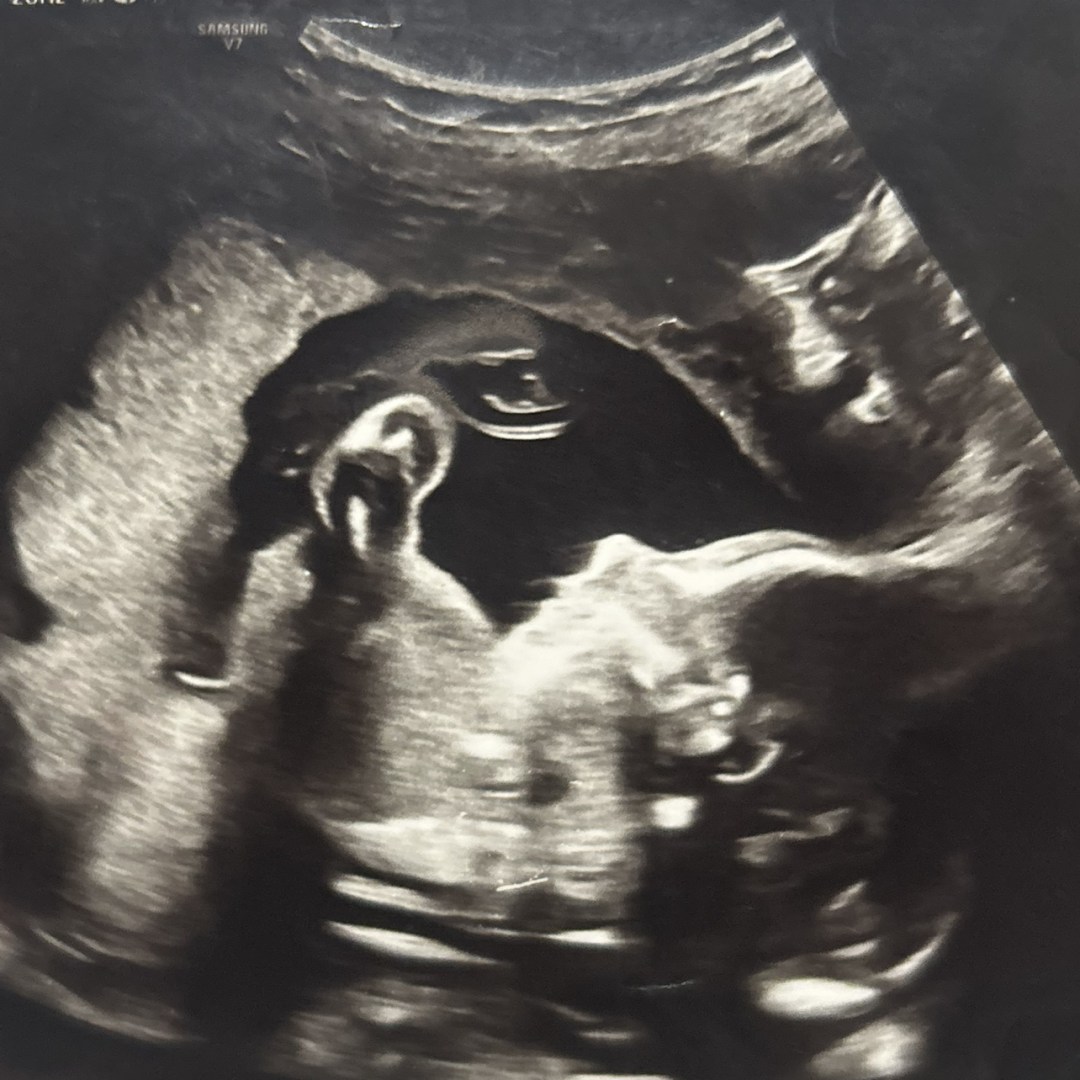 Photo shared by Kye for their Babylist baby registry.