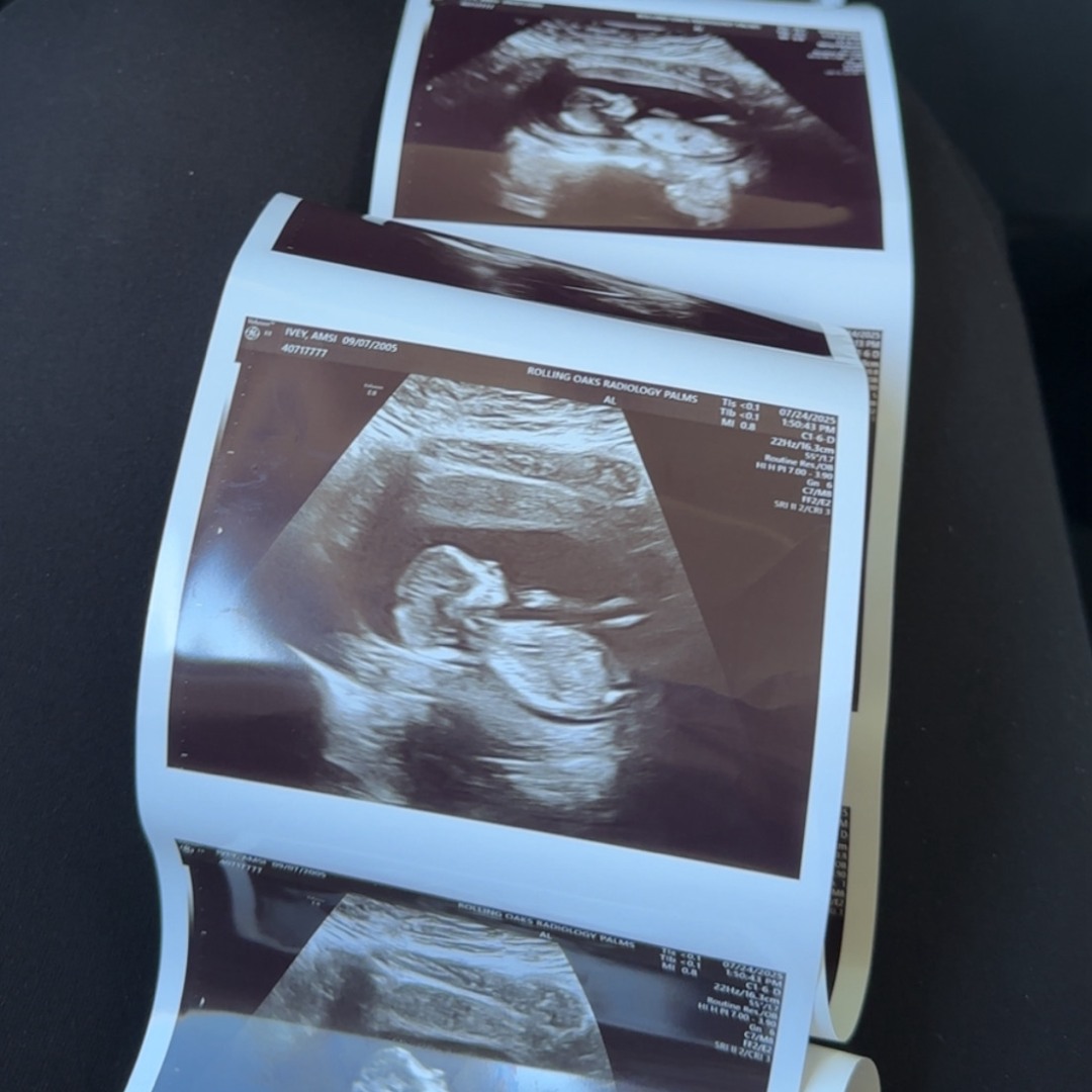 Photo shared by Amsi for their Babylist baby registry.