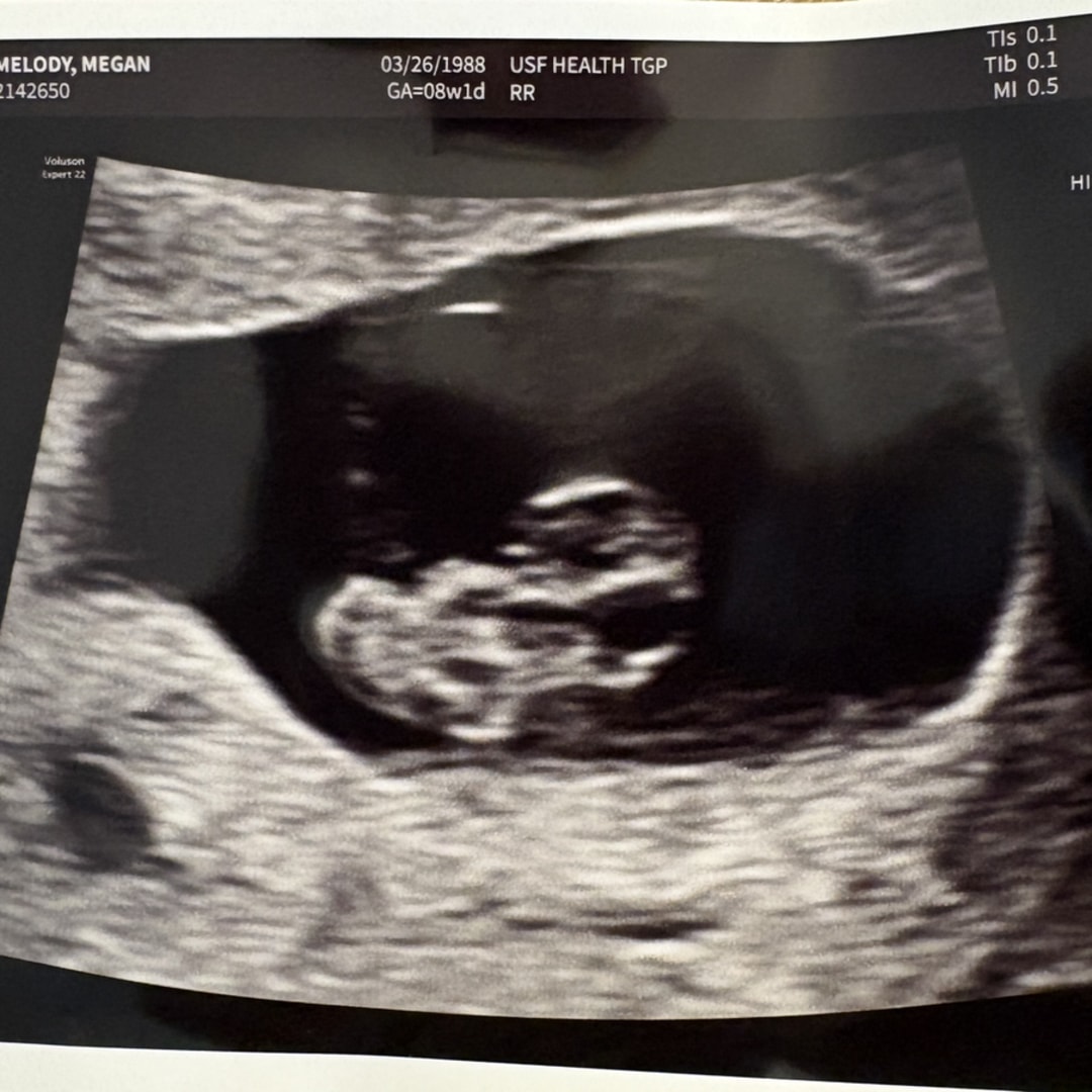 Photo shared by Megan for their Babylist baby registry.