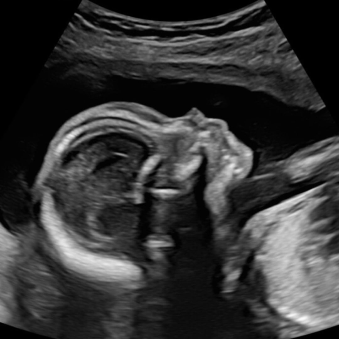 Photo shared by Anera for their Babylist baby registry.