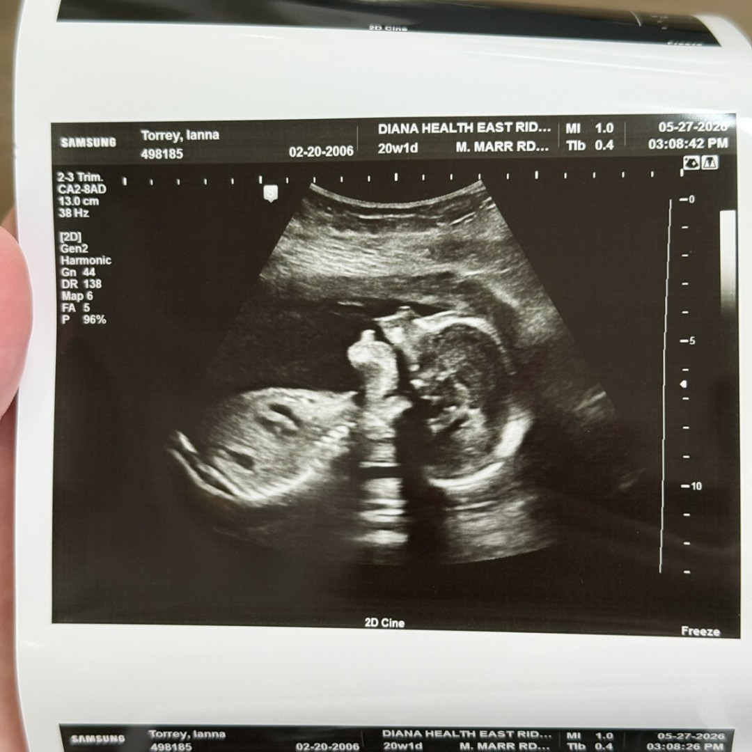 Photo shared by Ianna for their Babylist baby registry.