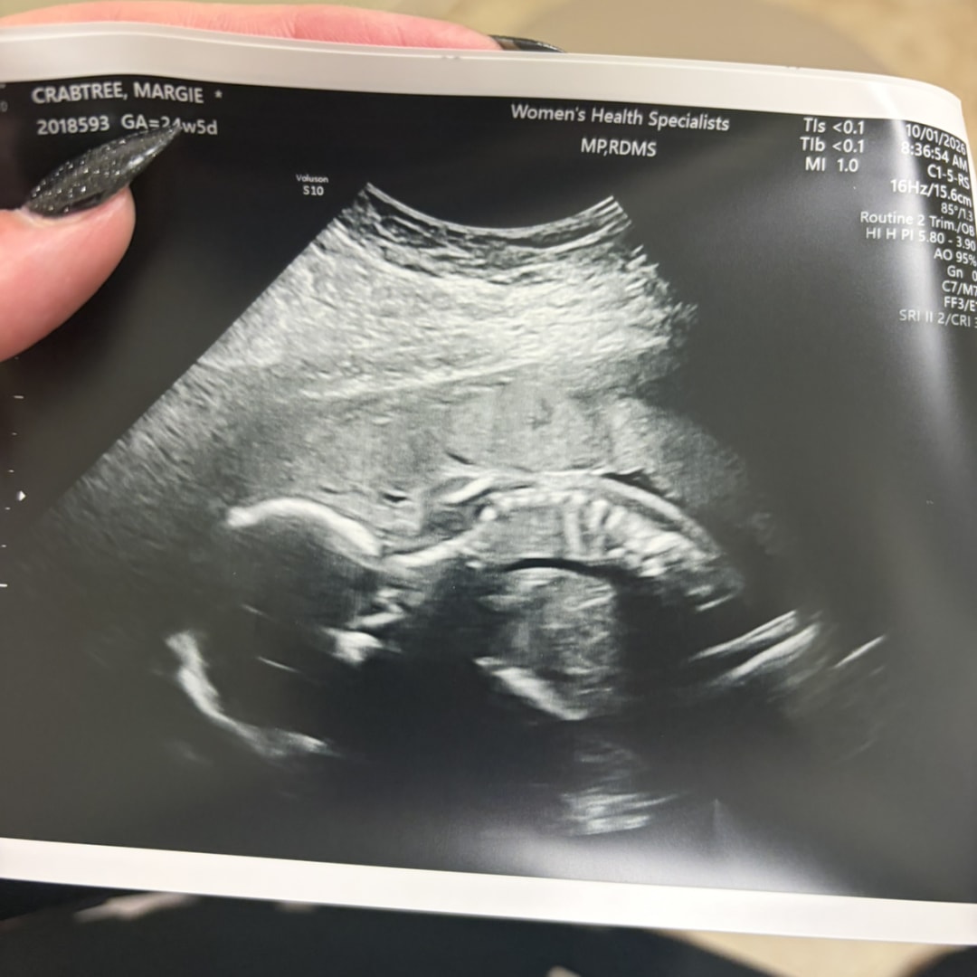 Photo shared by Margie for their Babylist baby registry.